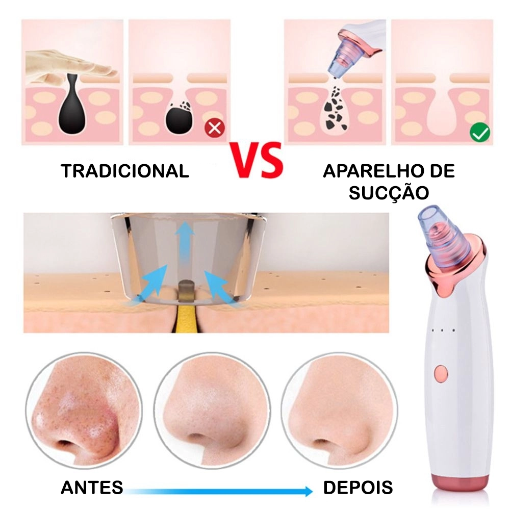 prevenção de cravos