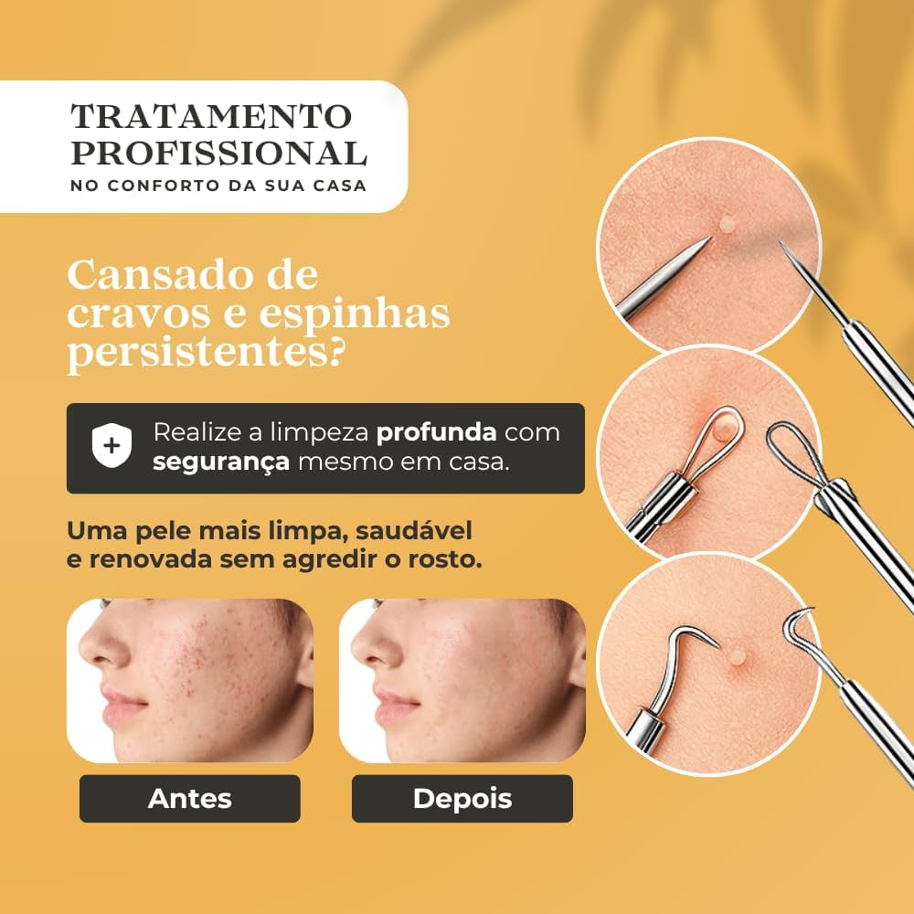 tipos de cravos